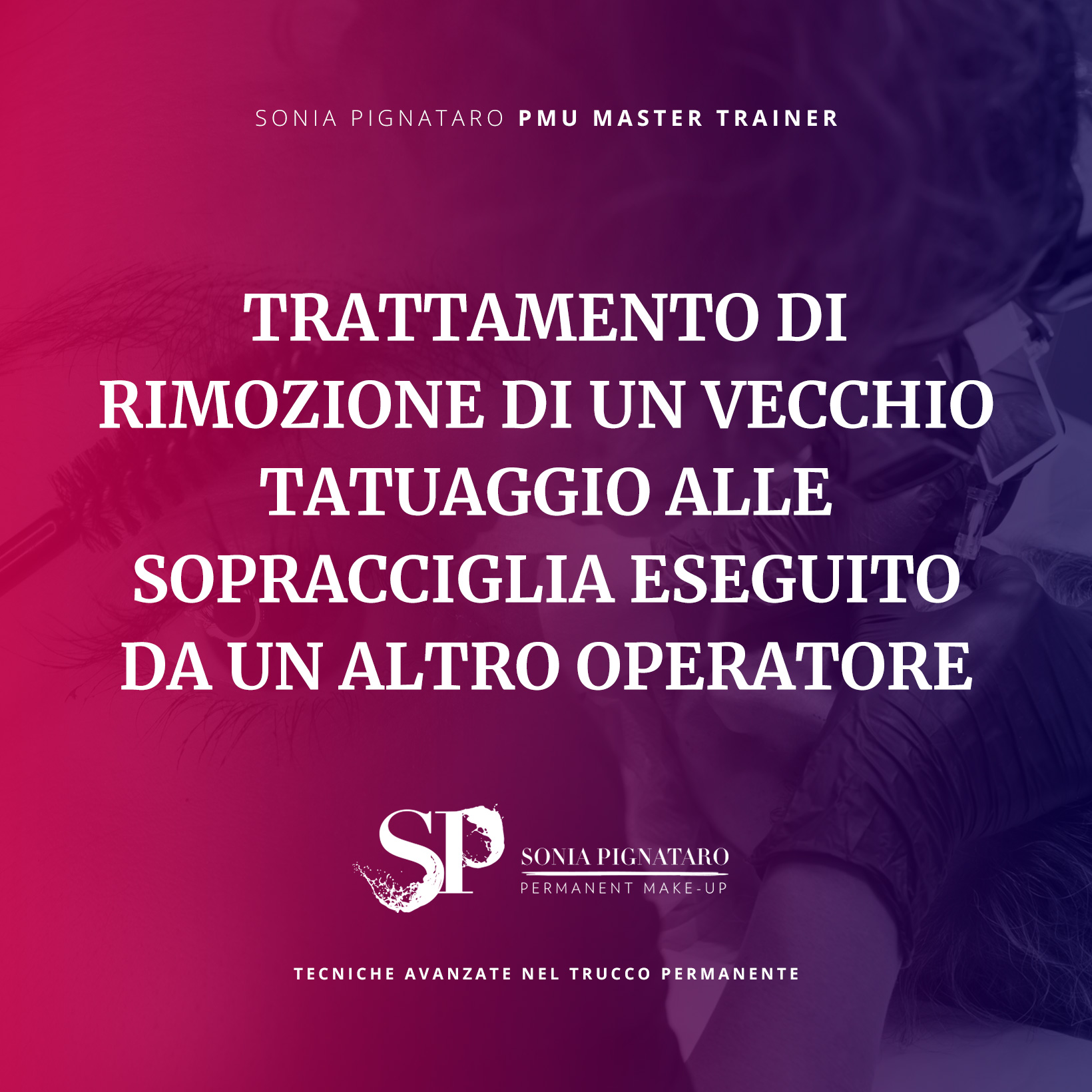 Trattamento di rimozione tatuaggio visagistico