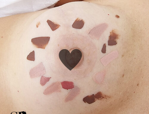 Tatuaggio paramedicale su seno: ricostruzione areola e capezzolo dopo intervento chirurgico