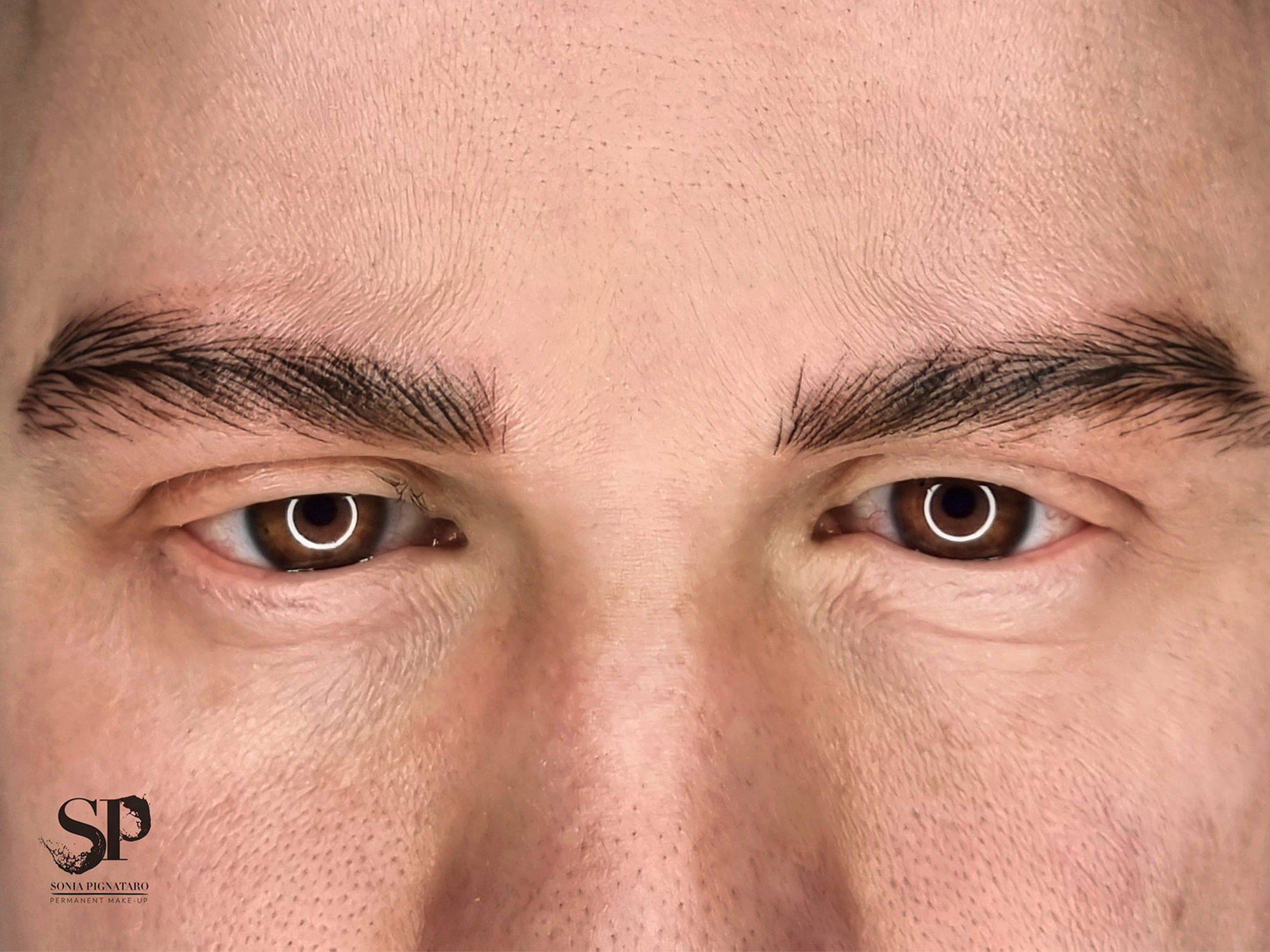 Alopecia sopracciglia maschile dopo il trattamento