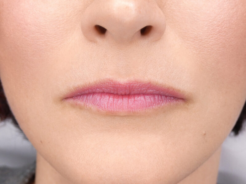 Labbra tatuate con tecnica trucco permanente – colore rosato naturale