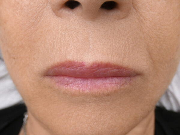 Trucco permanente labbra su pelle matura – pigmentazione delicata