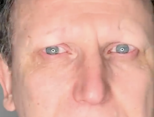 Trucco permanente su alopecia maschile
