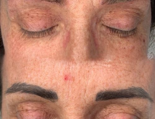 Pulizia del Colore: Il primo passo fondamentale per correggere un vecchio trucco permanente