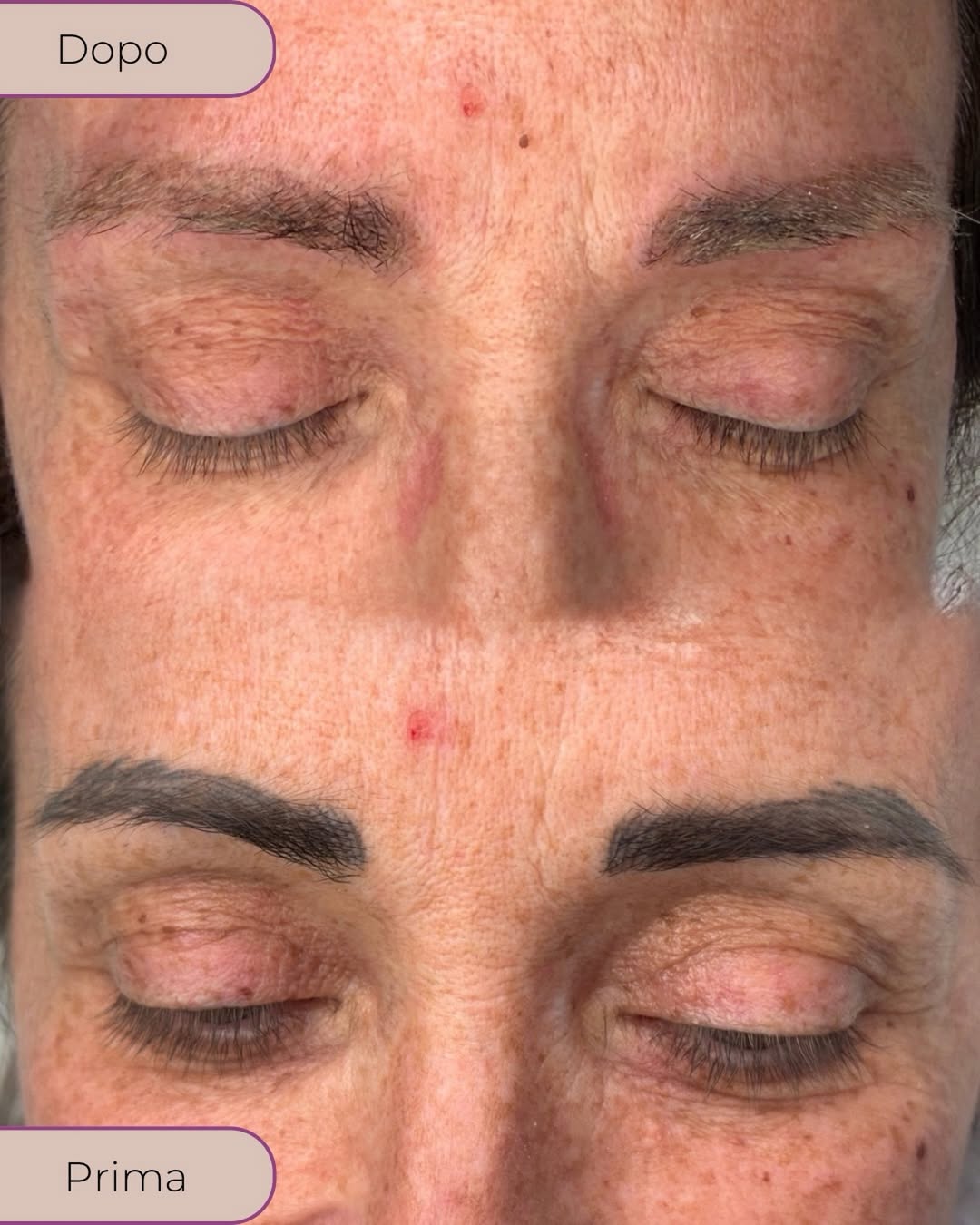 Prima e dopo la pulizia del colore di un vecchio trucco permanente alle sopracciglia, passaggio preparatorio eseguito a Roma da Sonia Pignataro.