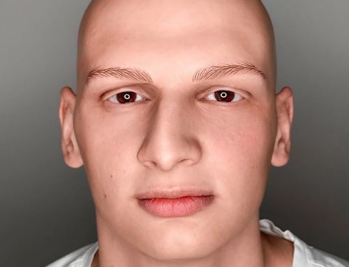 Alopecia: come ho ricostruito le sopracciglia di questo ragazzo